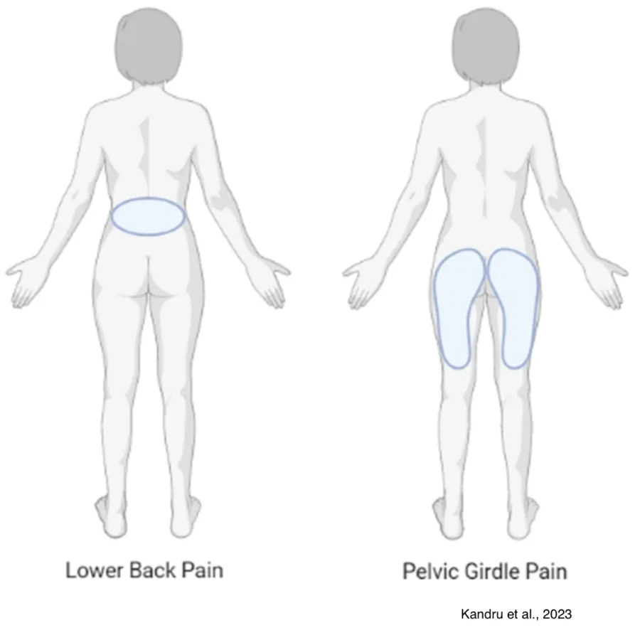 Pelvic girdle pain2 Brisbane chiropractor / chiropractic