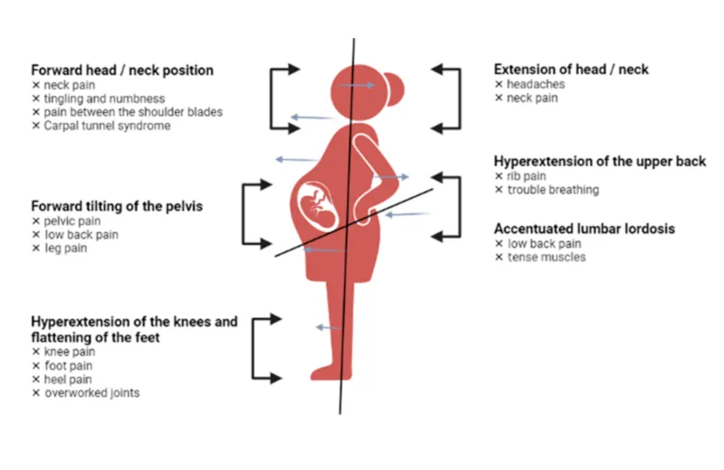 pregnancy-infographic Chiropractor dry needling